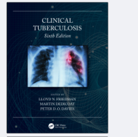 Clinical Tuberculosis