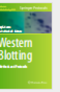 estern Blotting  Methods and Protocols