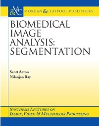 Image of Biomedical Image Analysis Segmentation