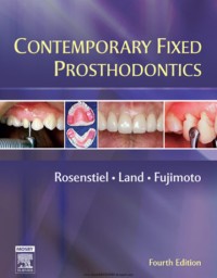 Image of Contemporary_Fixed_Prosthodontics 4th Edition