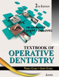 Image of Textbook of Operative Dentistry, 2E (2013) [UnitedVRG]